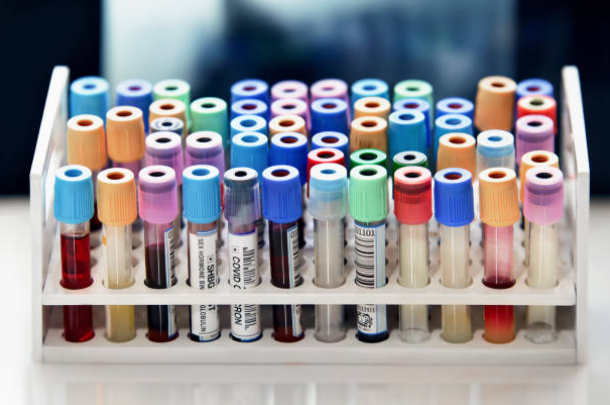 Test Tubes for Collection